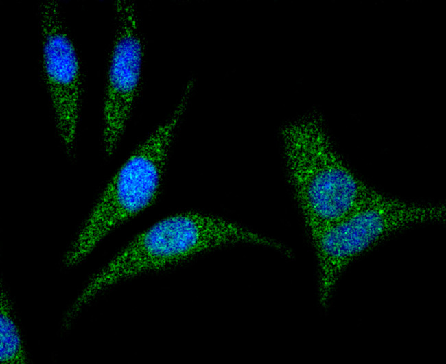 RhoA Antibody in Immunocytochemistry (ICC/IF)