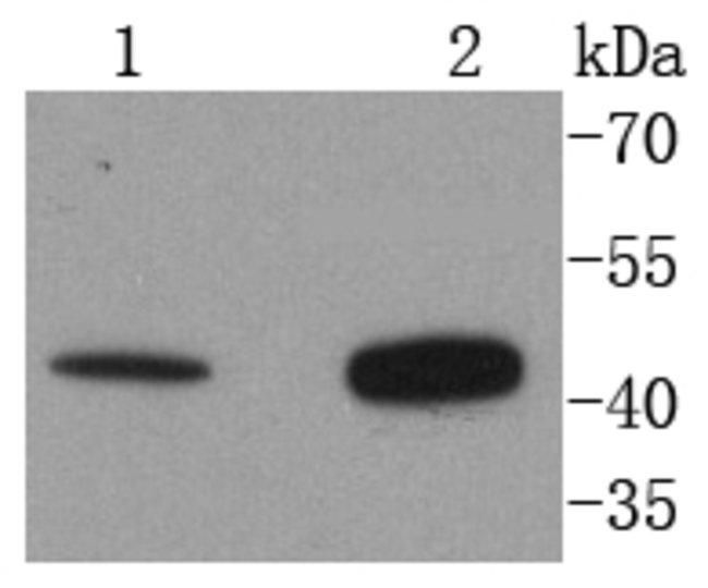 AGTR2 Antibody in Western Blot (WB)