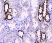 PPP1R1A Antibody in Immunohistochemistry (Paraffin) (IHC (P))