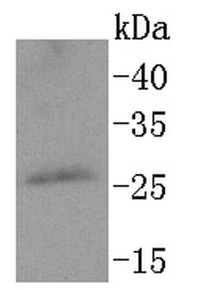 PPP1R1A Antibody in Western Blot (WB)