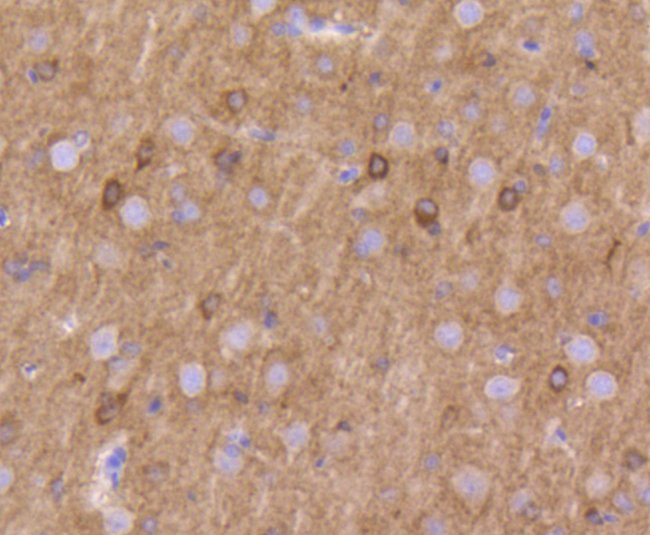 KV1.1 (KCNA1) Antibody in Immunohistochemistry (Paraffin) (IHC (P))