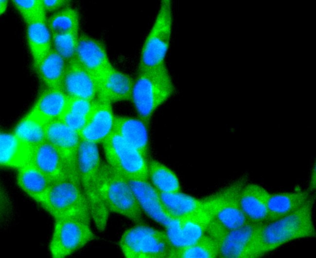 CD81 Antibody in Immunocytochemistry (ICC/IF)