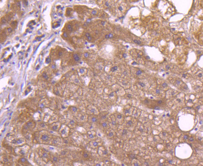 CD81 Antibody in Immunohistochemistry (Paraffin) (IHC (P))