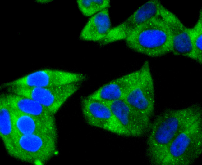 HSPB8 Antibody in Immunocytochemistry (ICC/IF)