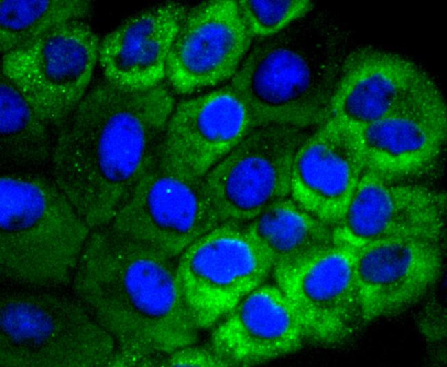 HSPB8 Antibody in Immunocytochemistry (ICC/IF)