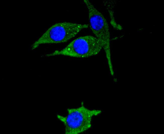 HSPB8 Antibody in Immunocytochemistry (ICC/IF)