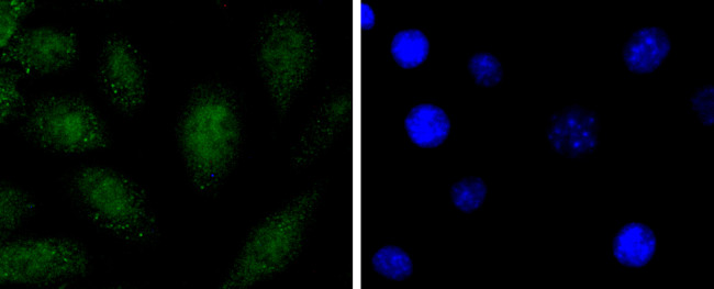 SOX1 Antibody in Immunocytochemistry (ICC/IF)