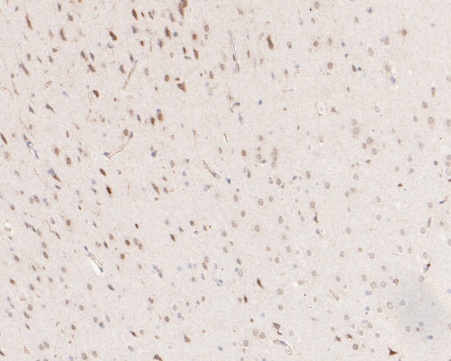 SOX1 Antibody in Immunohistochemistry (Paraffin) (IHC (P))