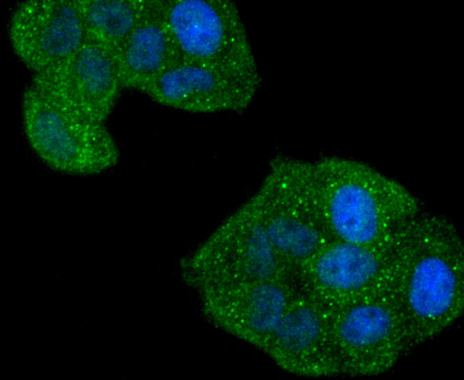 Phospho-RAC1/CDC42 (Ser71) Antibody in Immunocytochemistry (ICC/IF)