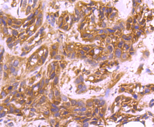 Cdc42 Antibody in Immunohistochemistry (Paraffin) (IHC (P))