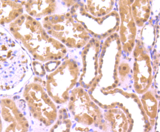 FUS Antibody in Immunohistochemistry (Paraffin) (IHC (P))