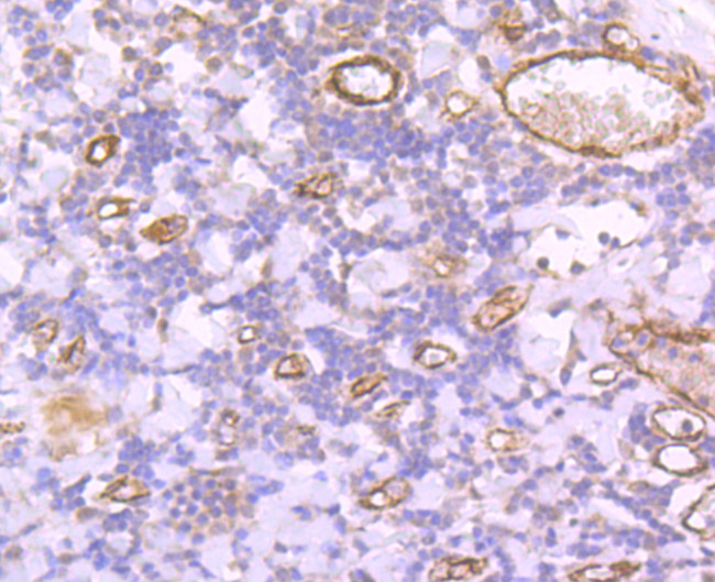 VWF Antibody in Immunohistochemistry (Paraffin) (IHC (P))