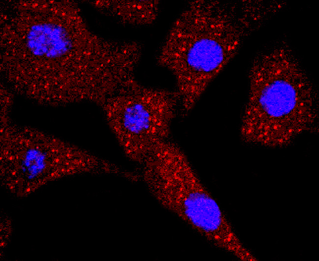 TK1 Antibody in Immunocytochemistry (ICC/IF)