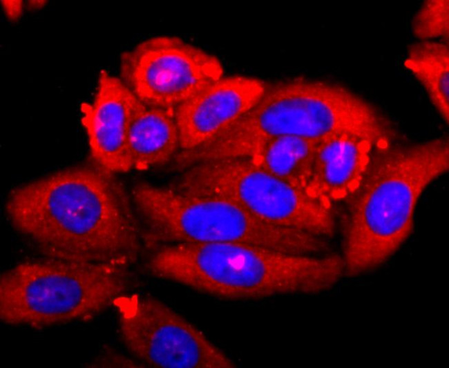 S100A9 Antibody in Immunocytochemistry (ICC/IF)