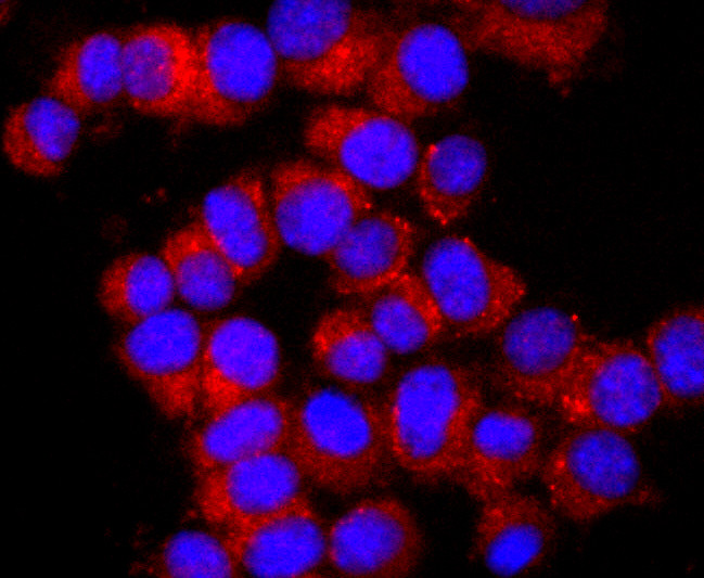 Ub-K63 Antibody in Immunocytochemistry (ICC/IF)