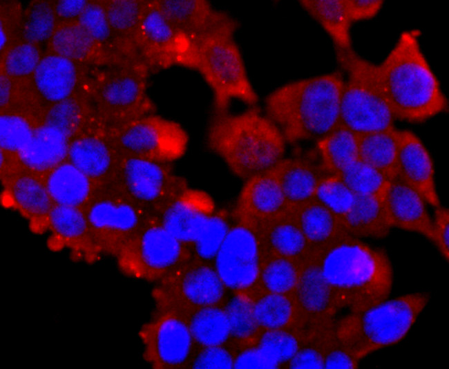 Ub-K63 Antibody in Immunocytochemistry (ICC/IF)