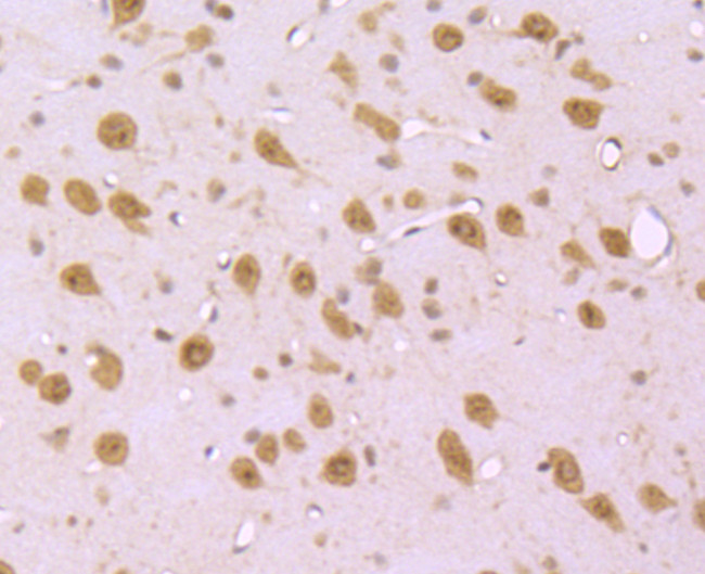 S1P1 Antibody in Immunohistochemistry (Paraffin) (IHC (P))