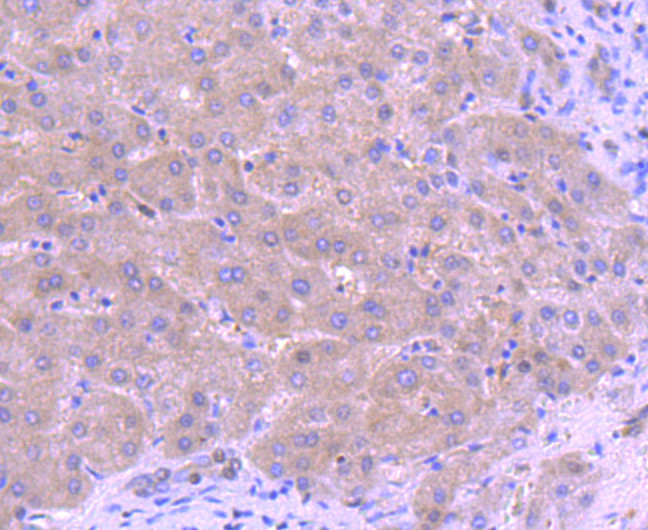 CTCF Antibody in Immunohistochemistry (Paraffin) (IHC (P))