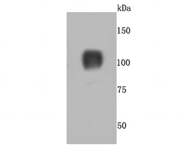 CD26 Antibody in Western Blot (WB)