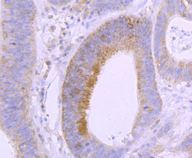 VDR Antibody in Immunohistochemistry (Paraffin) (IHC (P))