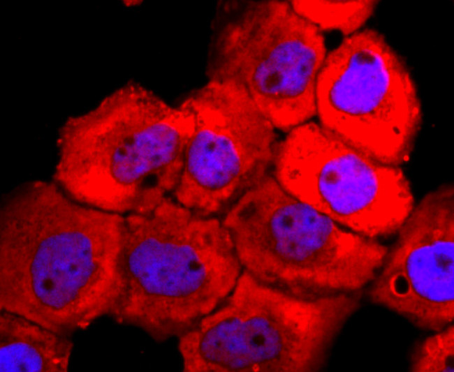 Tyrosinase Antibody in Immunocytochemistry (ICC/IF)