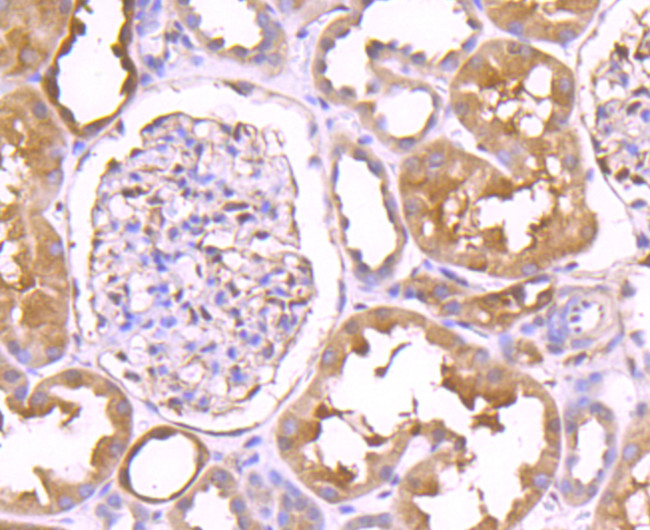 TrxR1 Antibody in Immunohistochemistry (Paraffin) (IHC (P))