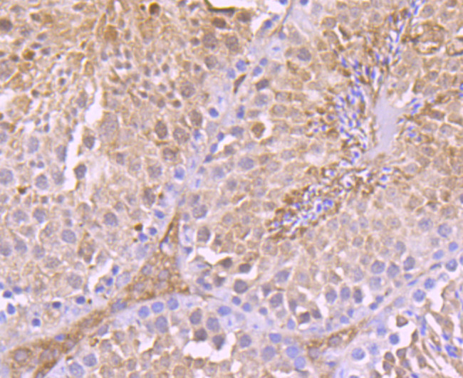 TrxR1 Antibody in Immunohistochemistry (Paraffin) (IHC (P))