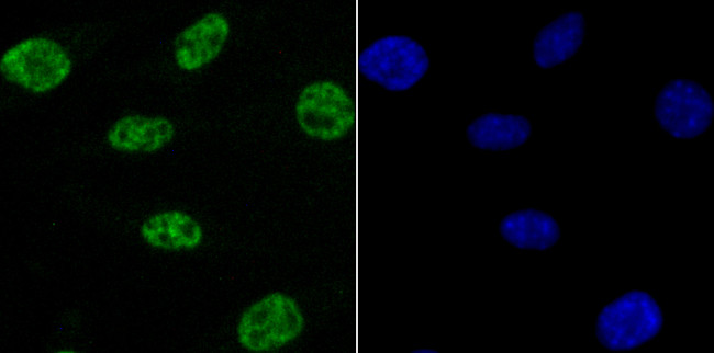 NRF1 Antibody in Immunocytochemistry (ICC/IF)