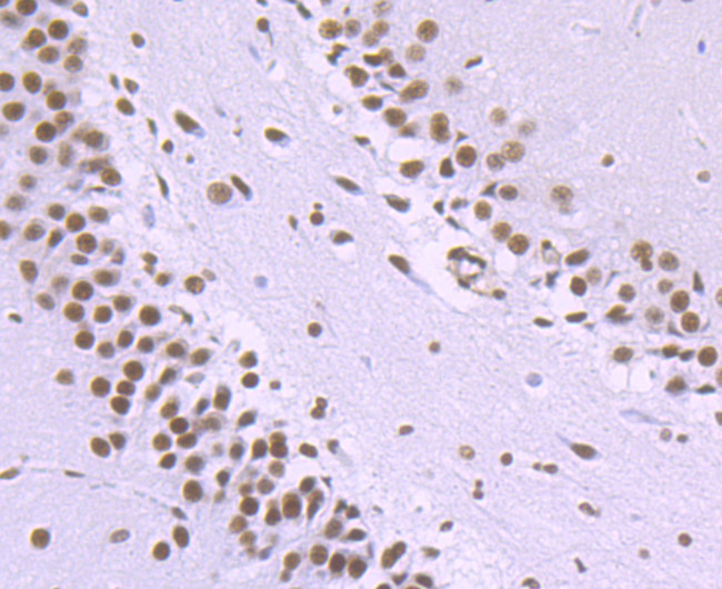 NRF1 Antibody in Immunohistochemistry (Paraffin) (IHC (P))