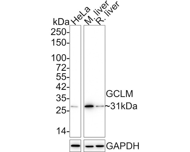 GCLM Antibody in Immunocytochemistry (ICC/IF)