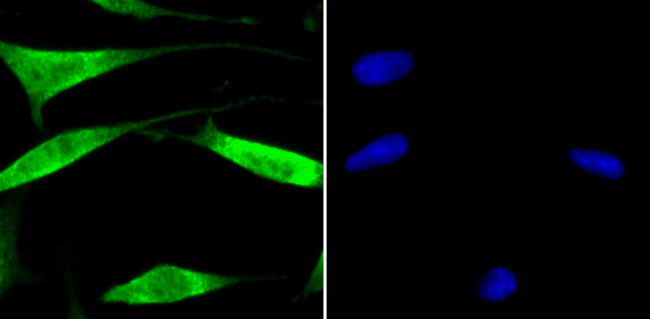 USP13 Antibody in Immunocytochemistry (ICC/IF)