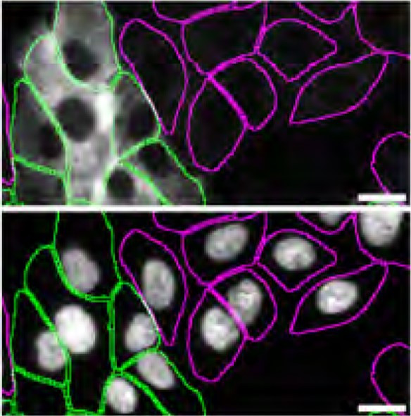 TGM2 Antibody in Immunocytochemistry (ICC/IF)