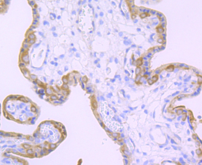 TGM2 Antibody in Immunohistochemistry (Paraffin) (IHC (P))