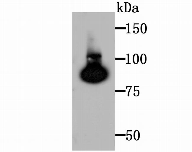 TGM2 Antibody in Western Blot (WB)