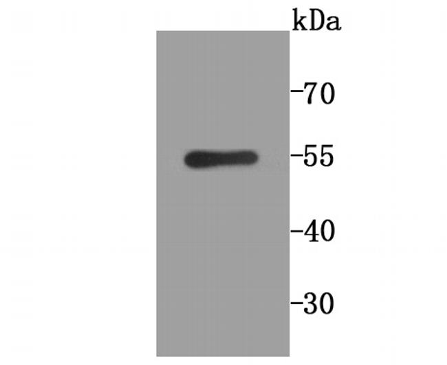 PGF Antibody in Western Blot (WB)
