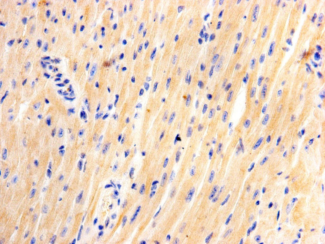 JPH2 Antibody in Immunohistochemistry (Paraffin) (IHC (P))