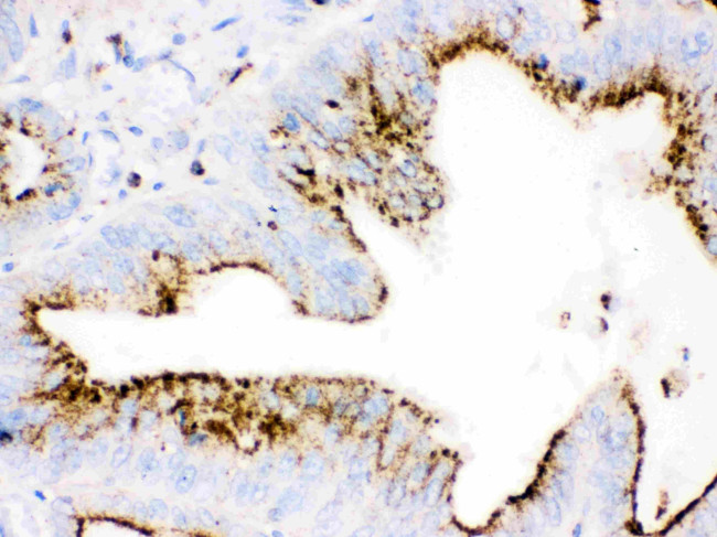 Cathepsin D Antibody in Immunohistochemistry (Paraffin) (IHC (P))