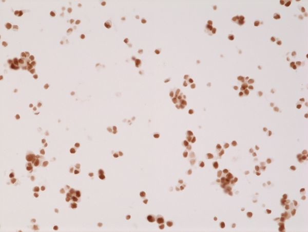 Androgen Receptor Antibody in Immunocytochemistry (ICC/IF)