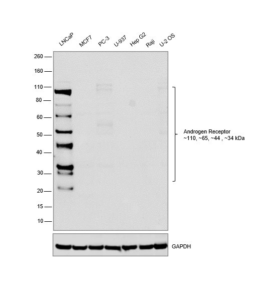 Androgen Receptor Antibody