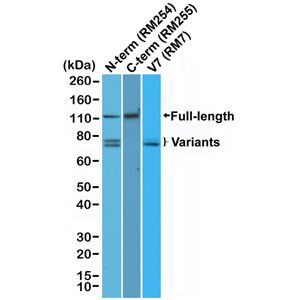 Androgen Receptor Antibody in Western Blot (WB)