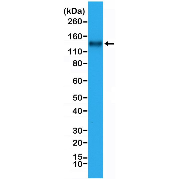 CD31 Antibody in Western Blot (WB)