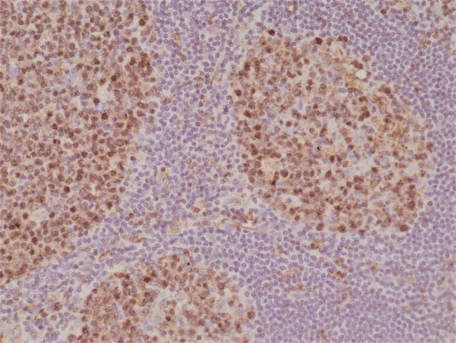 Stathmin 1 Antibody in Immunohistochemistry (Paraffin) (IHC (P))