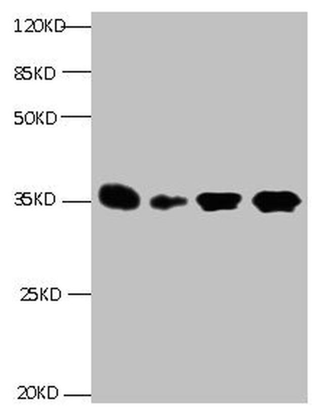 IGFBP-1 Antibody in Western Blot (WB)