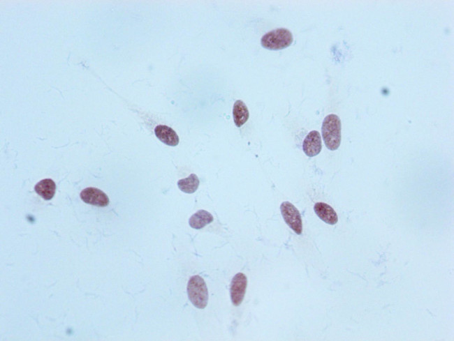 H3K18me1 Antibody in Immunocytochemistry (ICC/IF)