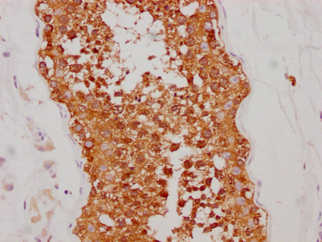 HSP90 alpha Antibody in Immunohistochemistry (Paraffin) (IHC (P))