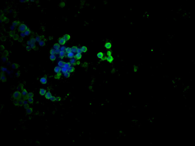 Phospho-p53 (Thr55) Antibody in Immunocytochemistry (ICC/IF)