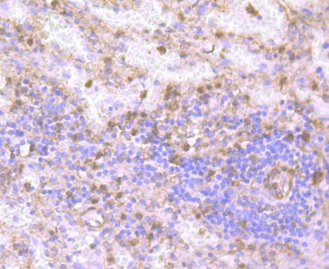 Gelsolin Antibody in Immunohistochemistry (Paraffin) (IHC (P))