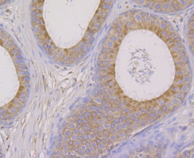 OS9 Antibody in Immunohistochemistry (Paraffin) (IHC (P))