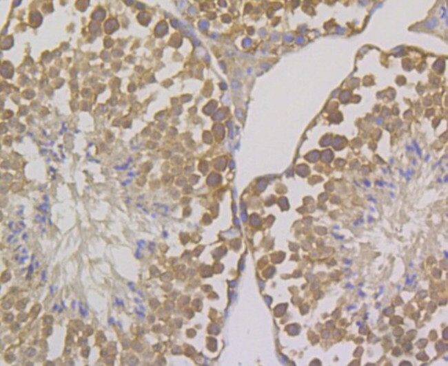 OS9 Antibody in Immunohistochemistry (Paraffin) (IHC (P))