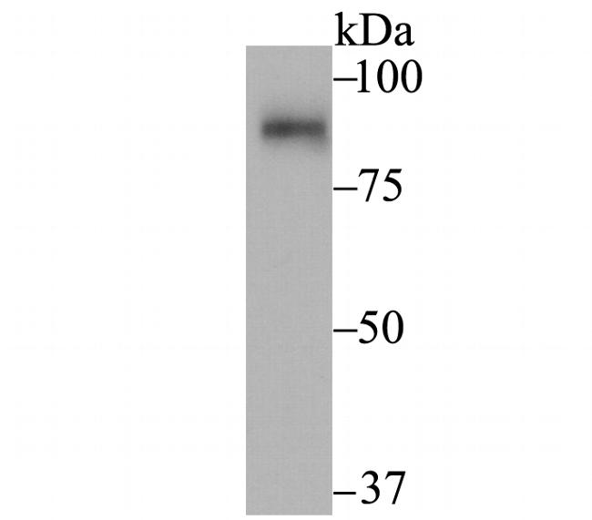 UNC84A Antibody in Western Blot (WB)